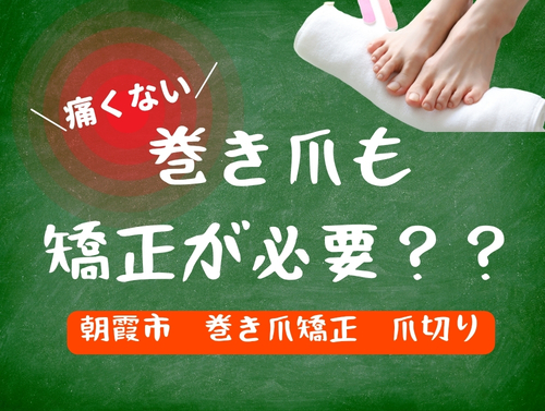【朝霞市】痛くない巻き爪！でも巻きが気になる方へ。